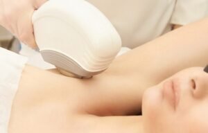 Laser Hair Removal: Fast, Effective, and Reliable