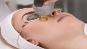 إزالة الشعر بالليزر في الرياض