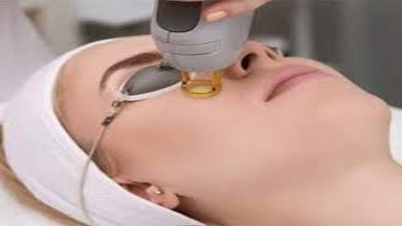 إزالة الشعر بالليزر في الرياض