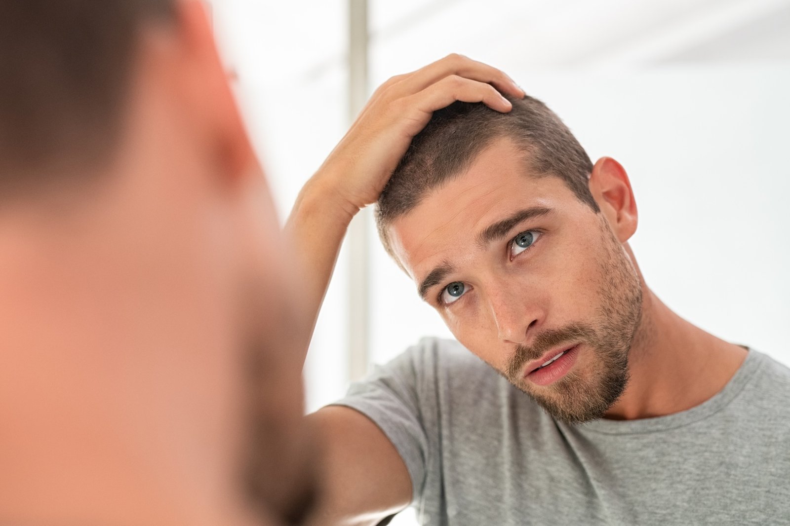What Causes Men to Choose Hair Replacement?