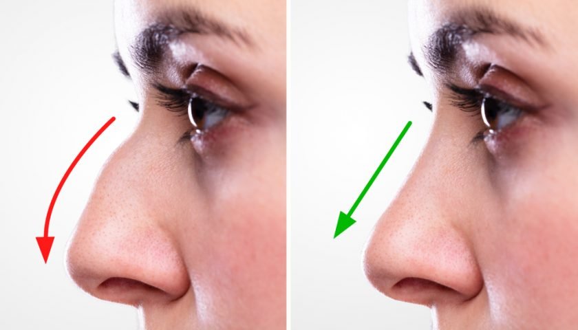 best rhinoplasty in islamabad