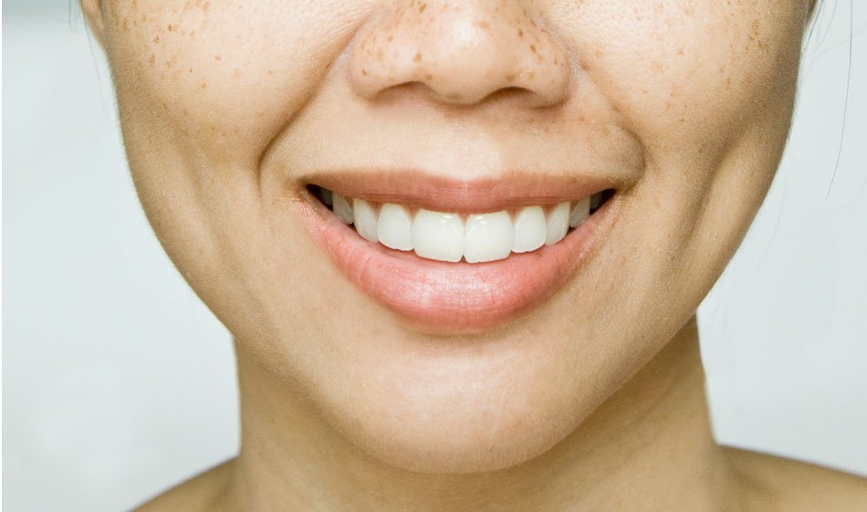 Dimple Creation Surgery in Dubai