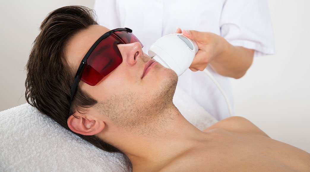 Does Beard Laser Hair Removal Affect Beard Growth?