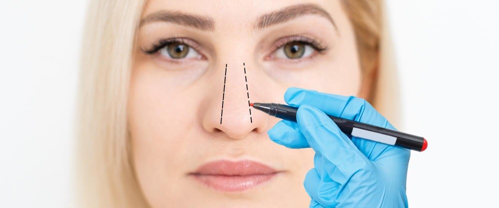 Enhance Your Natural Beauty with Professional Rhinoplasty