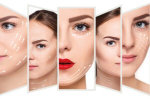 Fotona 4D Facelift Treatment: Your Path to Younger Skin