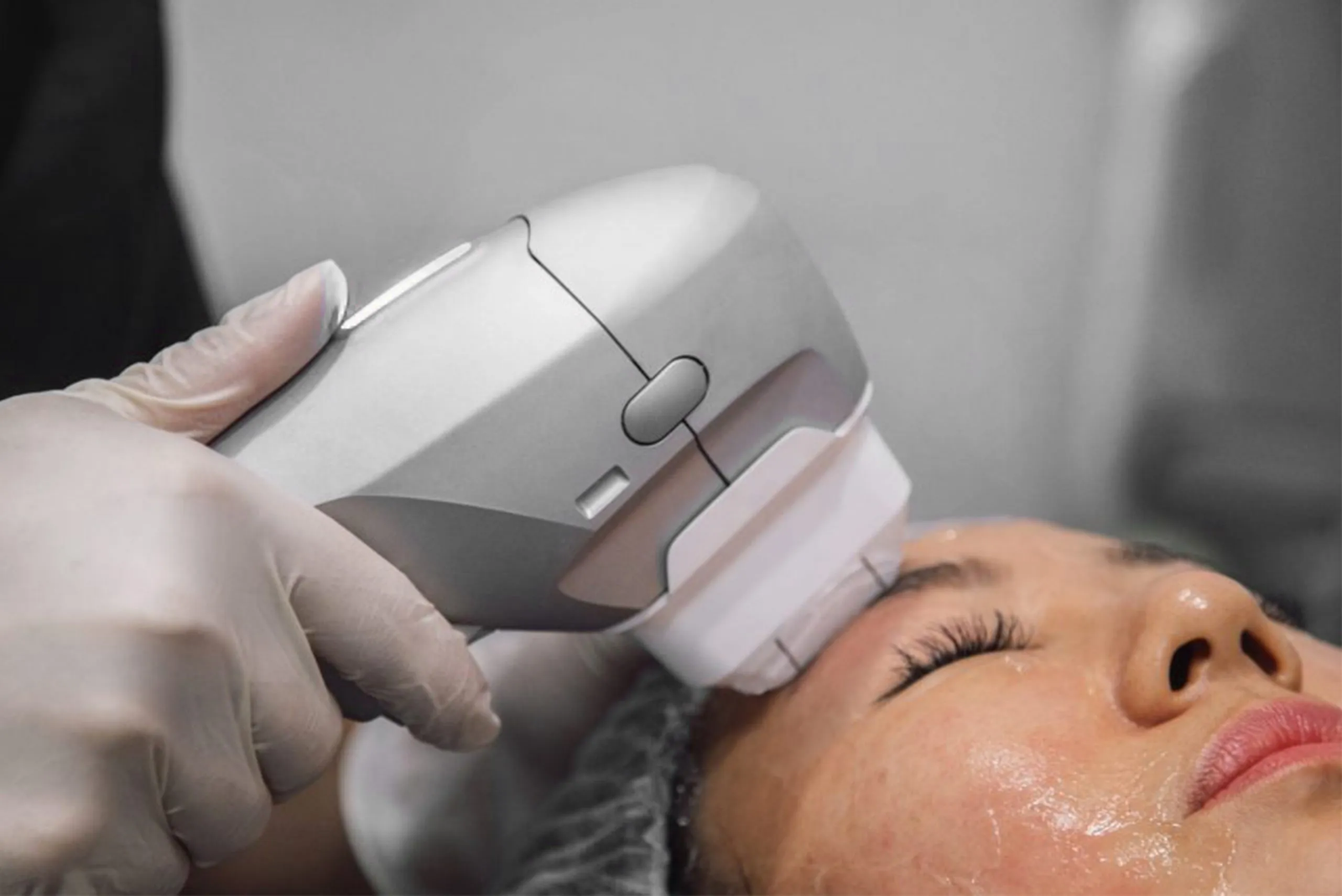 How HIFU Treatment Boosts Collagen Production Fast
