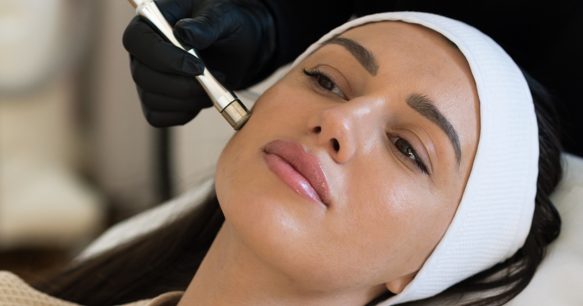How Microdermabrasion Treatment Helps Uneven Skin Tone