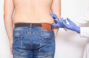 Is Fat Dissolving Injections Suitable for Men?