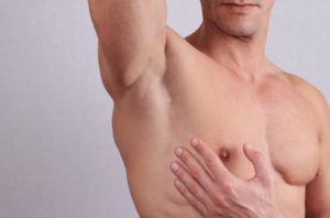 Is Gynecomastia Surgery Done Under General Anesthesia?