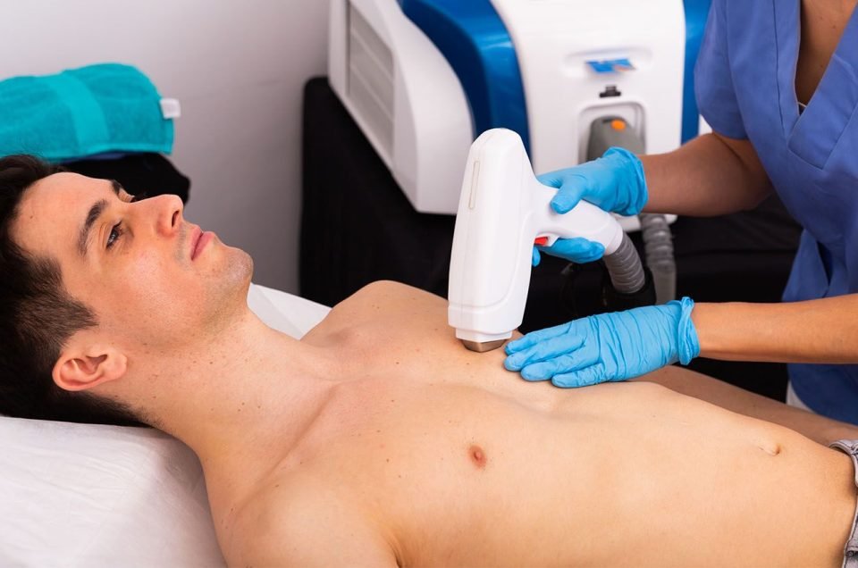 Is Men’s Laser Hair Removal Right for Chest Hair