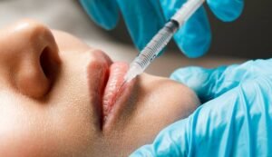Lip Botox That Might Be Worth the Hype