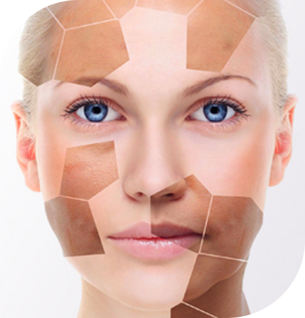 Radiant Skin Awaits with Proven Skin Whitening Ideas