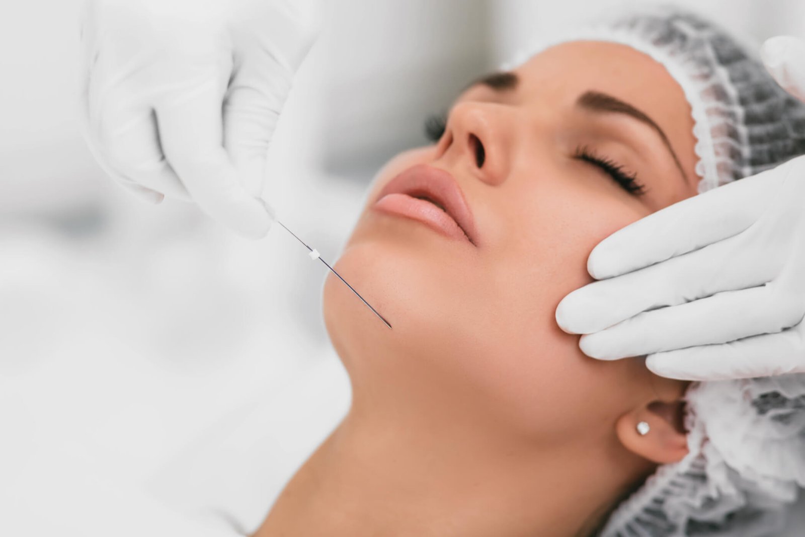 Silhouette Soft Thread Lift in Dubai
