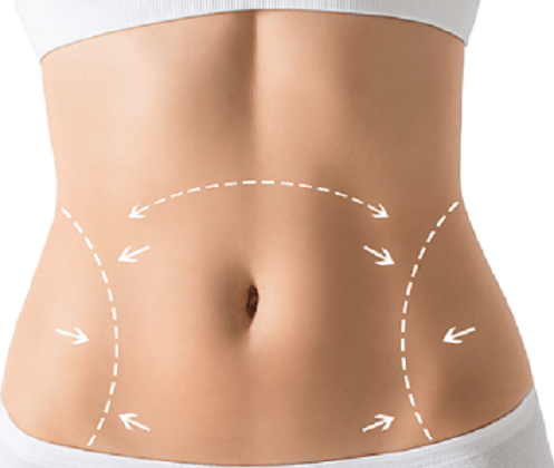 Tummy Tuck: Achieve a Sleek, Toned Midsection