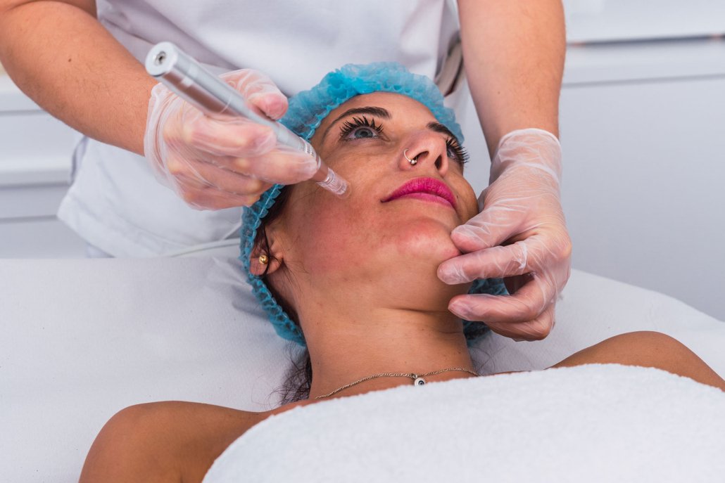 What Makes Mesotherapy a Popular Skin Solution?