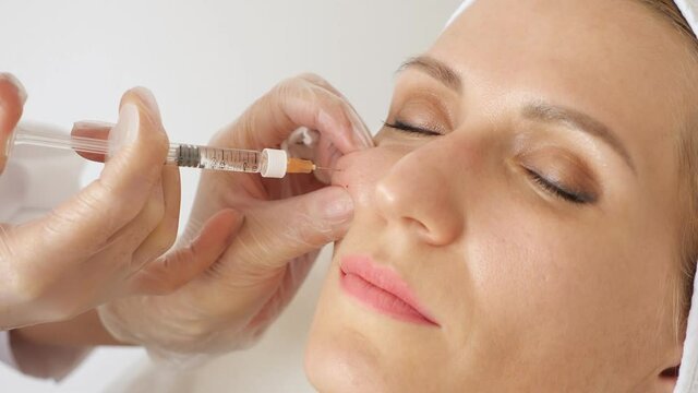 Skin Booster Injection Dubai