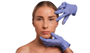 Blepharoplasty Dubai