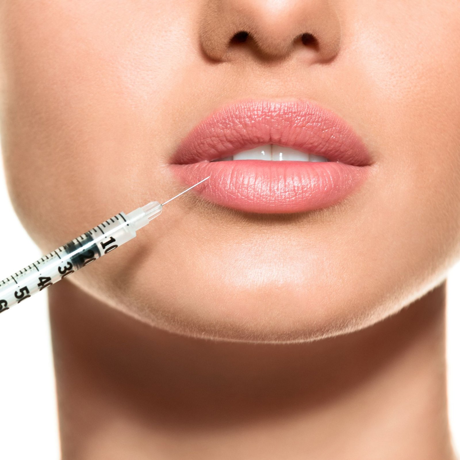Juvederm Filler Dubai