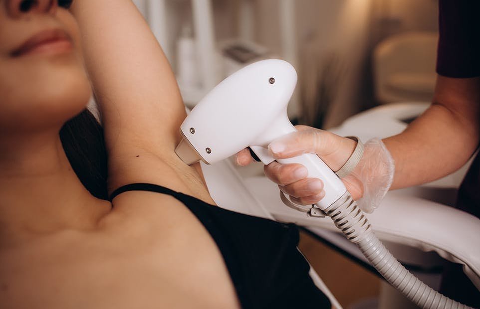 Laser Hair Removal in Dubai