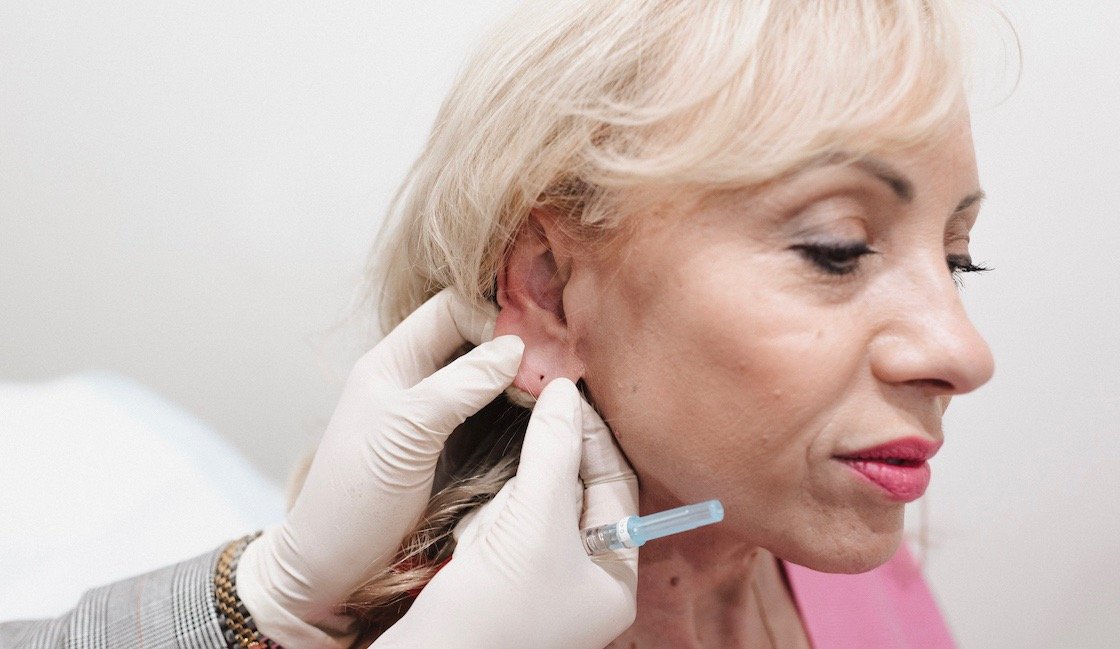 Otoplasty in Dubai