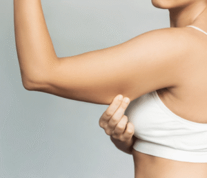 Arm Lift Surgery in Dubai