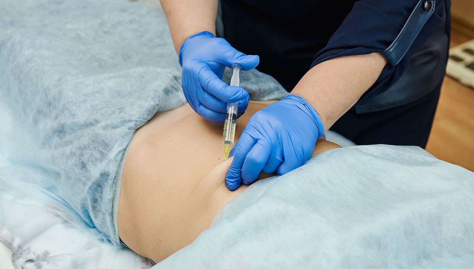 How Popular Are Fat Dissolving Injections Worldwide