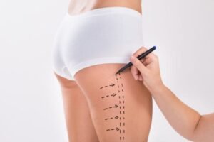 Is a Plastic Surgeon Best for Thigh Lift Procedures?