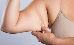 Arm Lift in Dubai