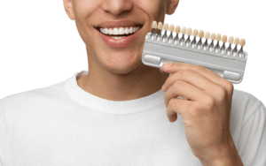 Transform Your Smile Fast with Dental Veneers in Dubai