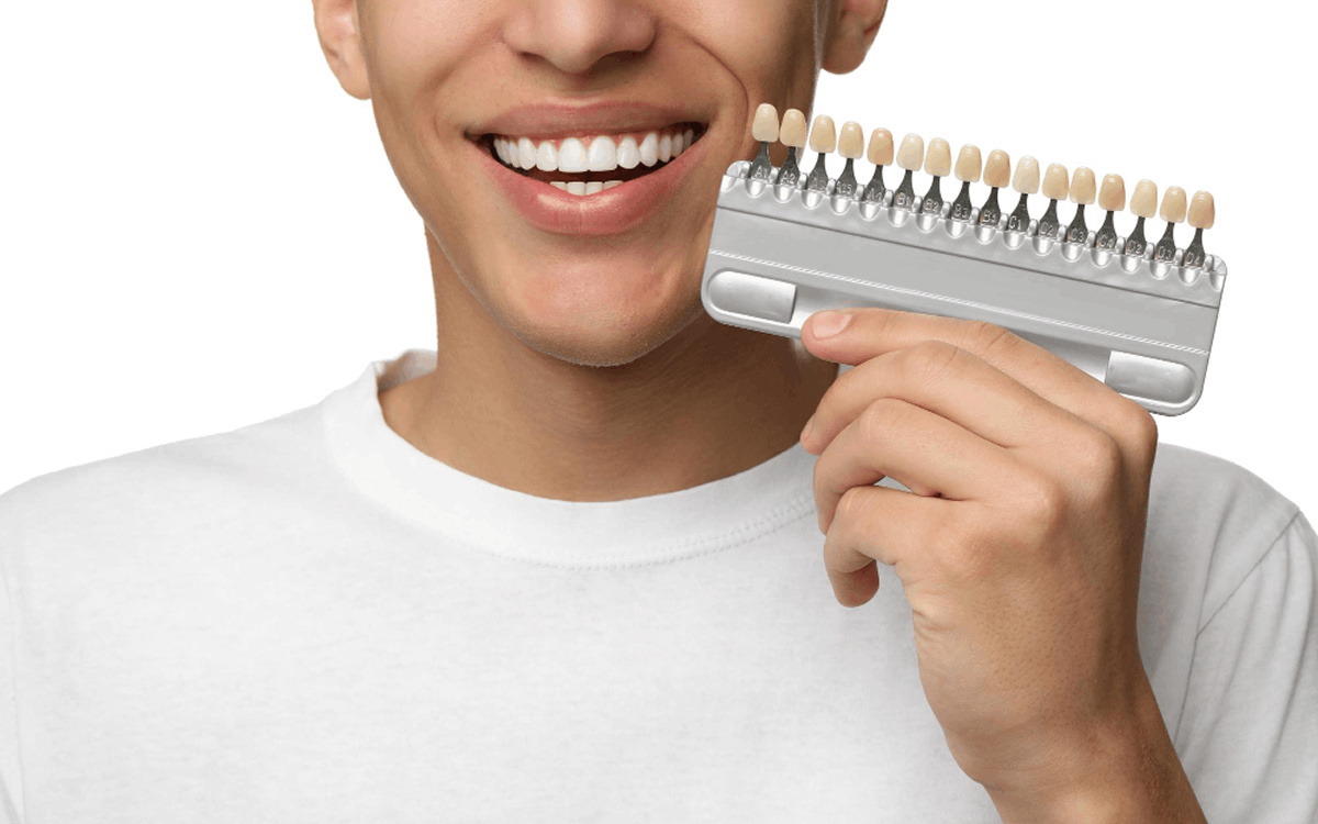 Transform Your Smile Fast with Dental Veneers in Dubai