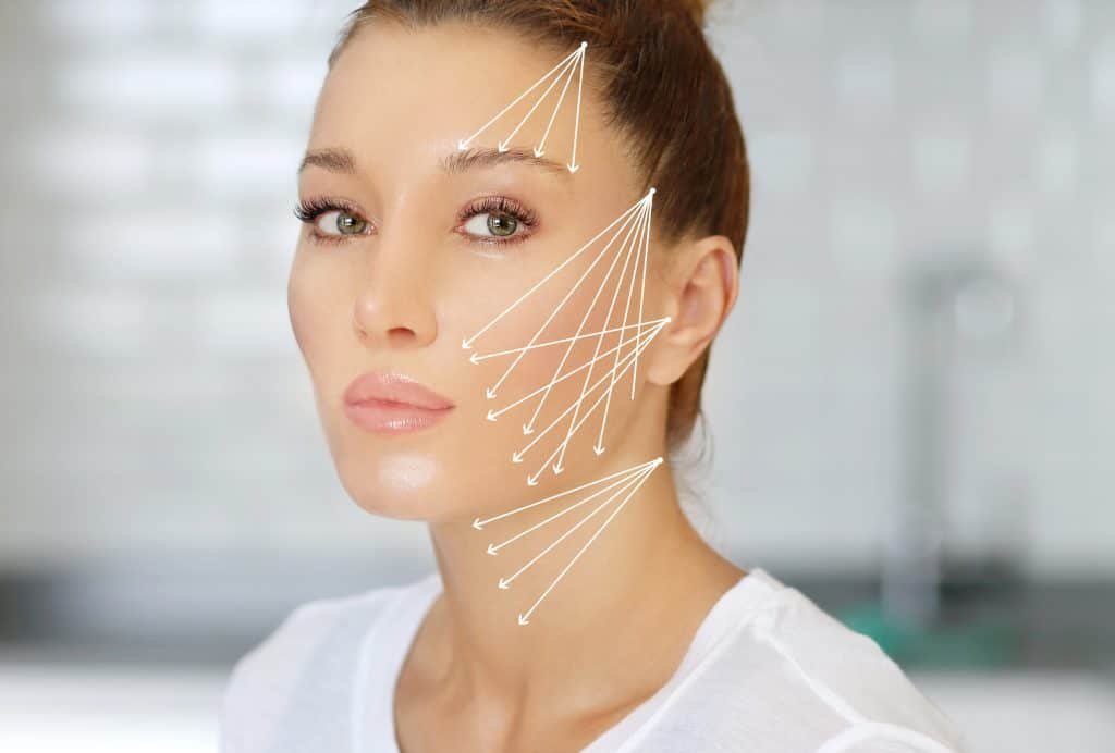 What Thread Lift Treatment Results Look Like After