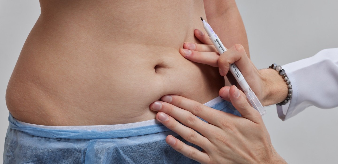 Fat Melting Injections in Dubai