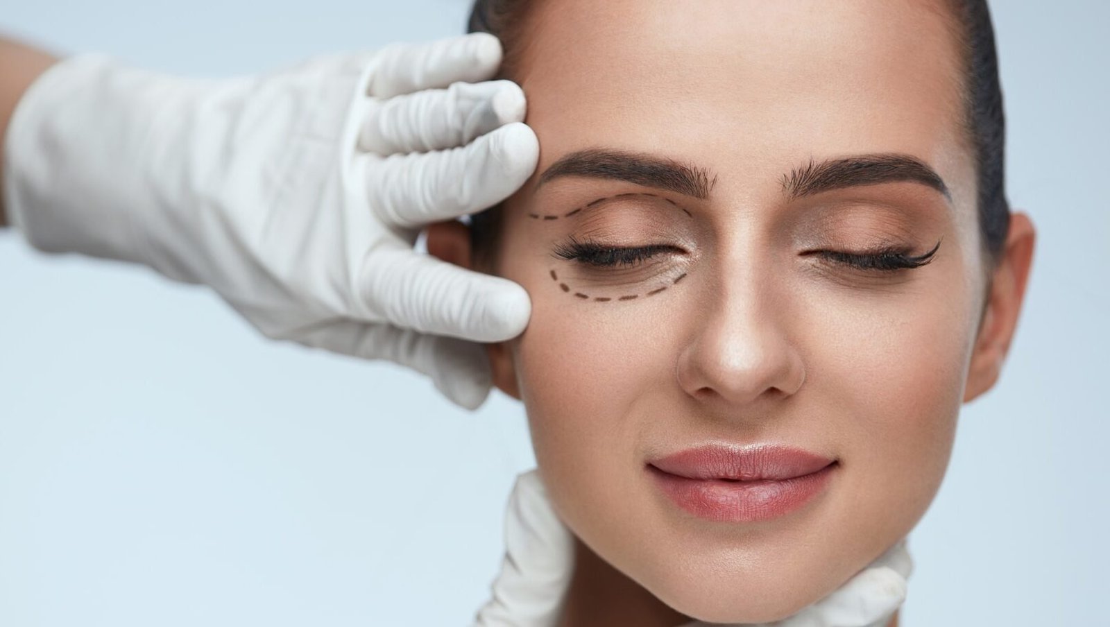 Blepharoplasty Dubai