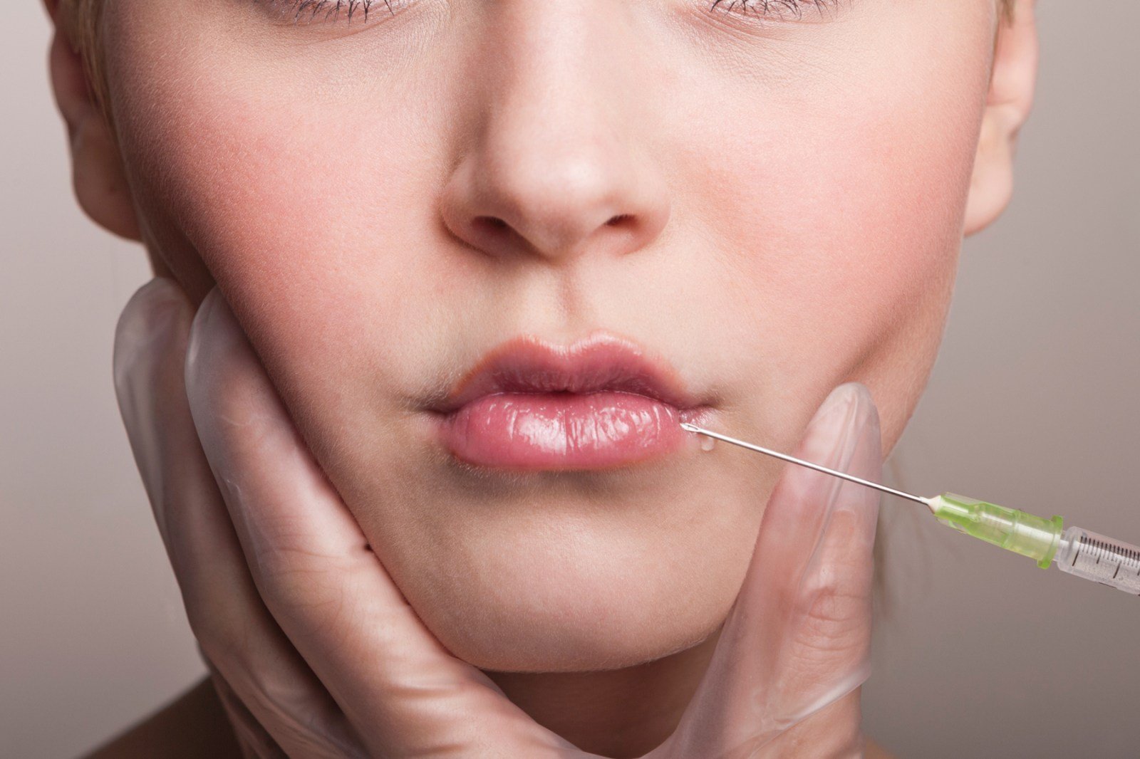 Lip Fillers in Dubai