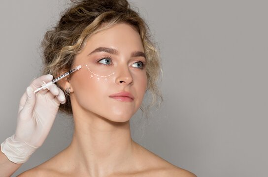 Under-Eye Filler Treatment in Dubai