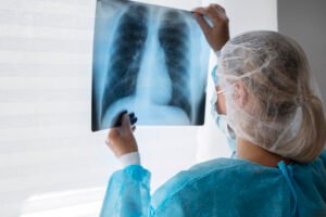 X RAY CHEST PA