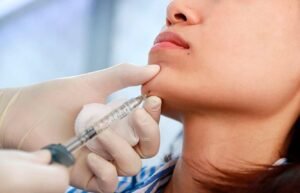 Cheek Fillers in Dubai