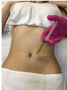 Aqualyx Injection Dubai