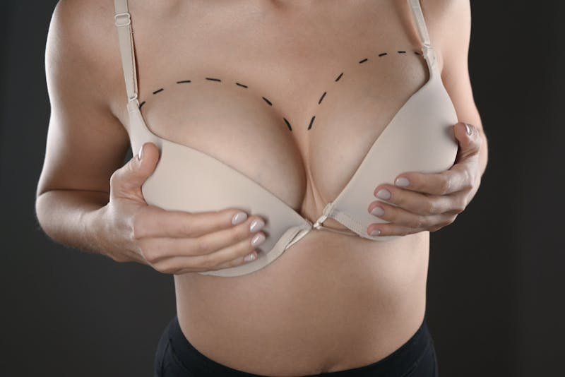 Dubai Breast Surgery Before & After Transformation Guide