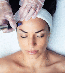Dubai Laser Scar Removal: Smooth Skin in Few Sessions