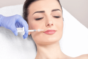 Russian Lip Filler in Dubai