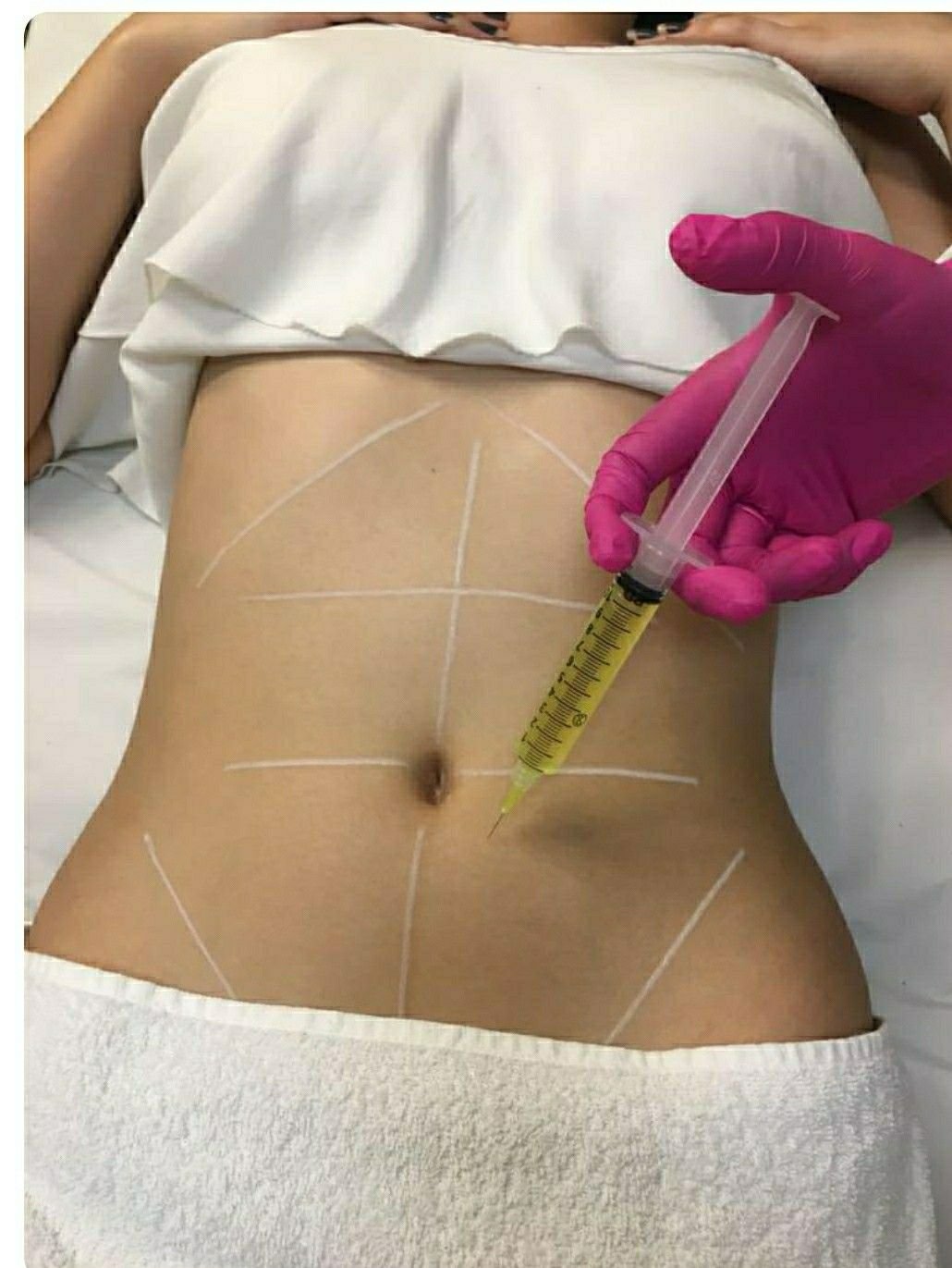 Aqualyx Injection Dubai