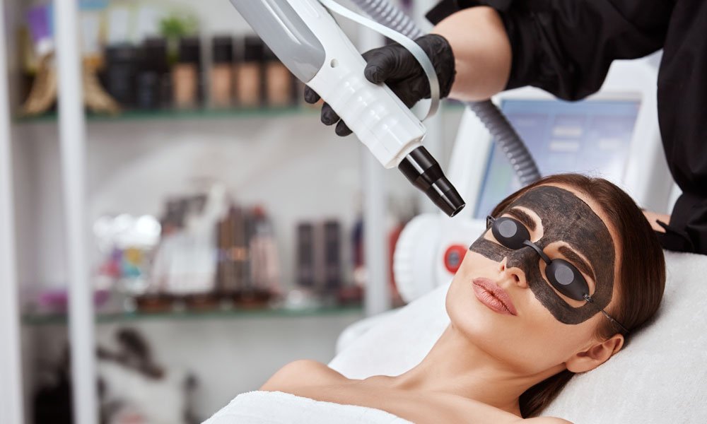 How Laser Carbon Peel Improves Skin Tone and Glow?