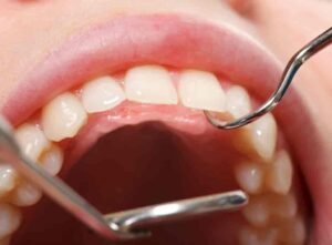 Leading Dental Clinic in Dubai for Dental Implant Experts