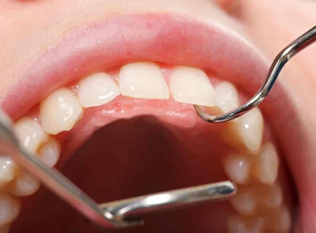 Leading Dental Clinic in Dubai for Dental Implant Experts