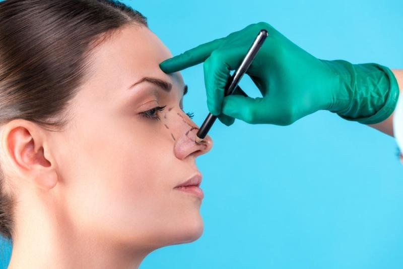 Nose Fillers in Dubai