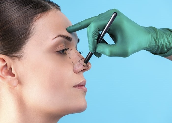 جراحة تجميل الأنف
