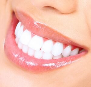 Teeth Whitening Dubai Clinics: Compare Prices & Techniques