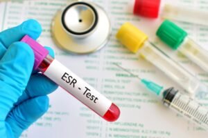 esr test price