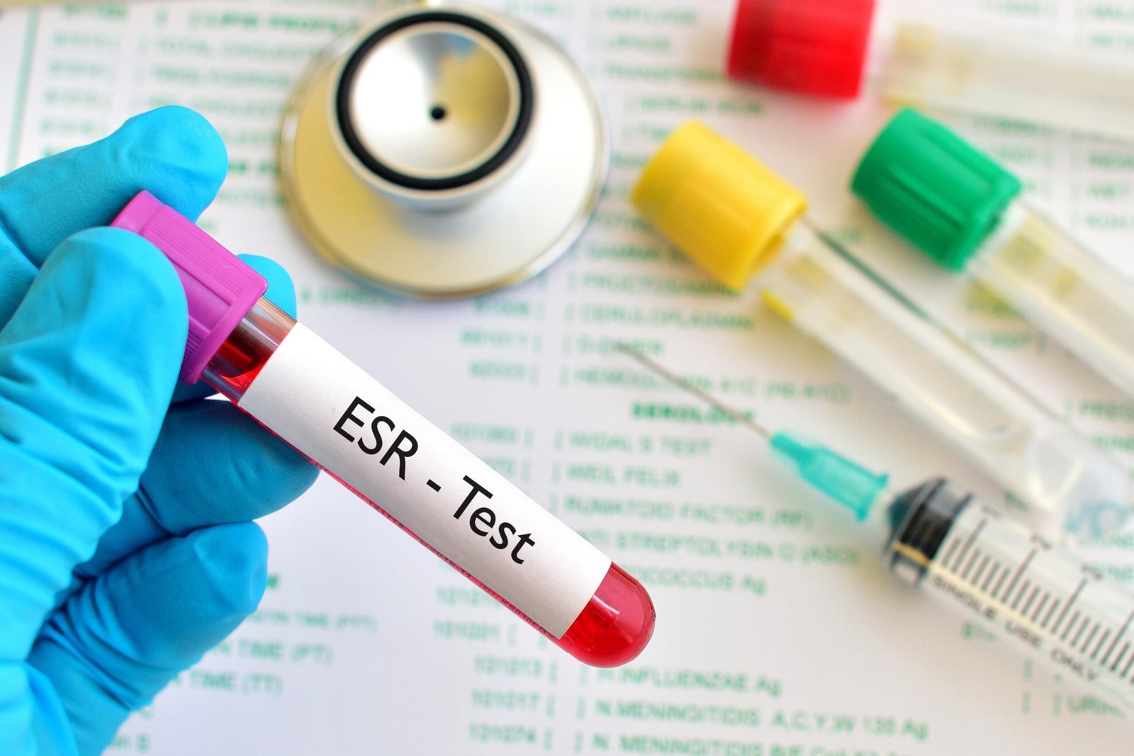 esr test price